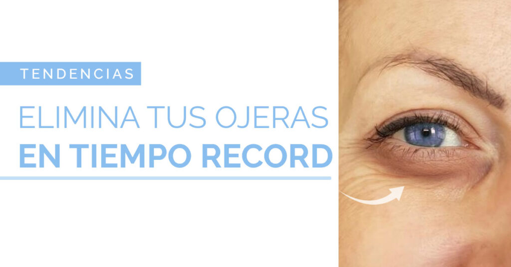 Elimina Tus Ojeras En Tiempo Record Cl Nica Elements Cirug A Y